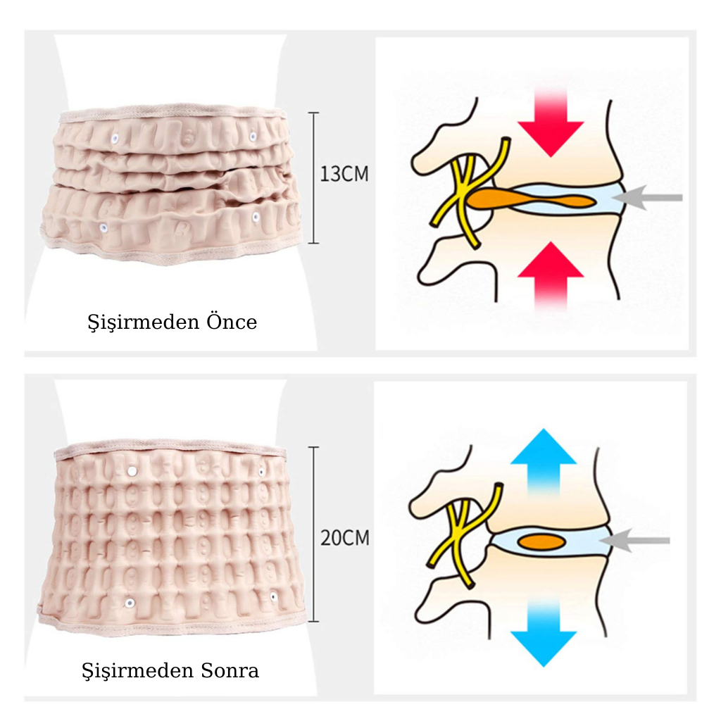 Yapeka™ Bel Dekompresyon Kemeri