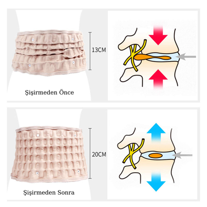 Yapeka™ Bel Dekompresyon Kemeri